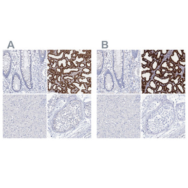 Anti CSN3 pAb (ATL-HPA035954 w/enhanced validation)