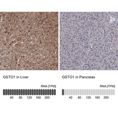 Anti GSTO1 pAb (ATL-HPA037603 w/enhanced validation)