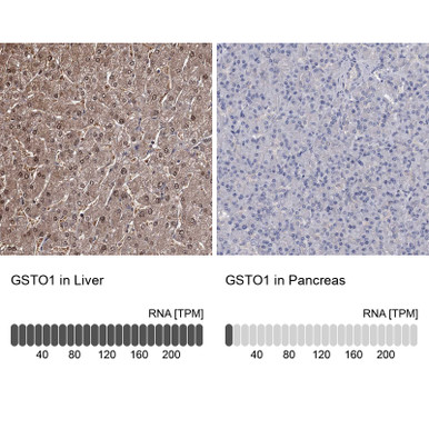 Anti GSTO1 pAb (ATL-HPA037604 w/enhanced validation)