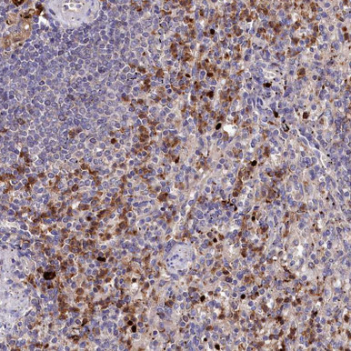 Anti KLRB1 pAb (ATL-HPA039113)