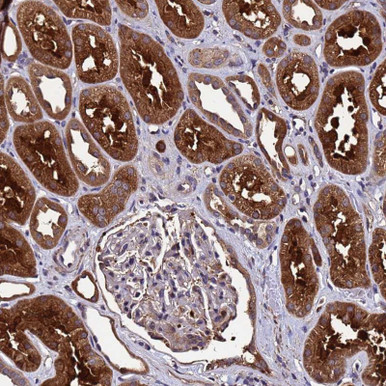 Anti GSTCD pAb (ATL-HPA046160)
