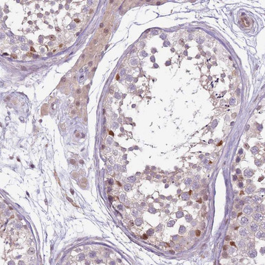 Anti GSTO2 pAb (ATL-HPA048141)