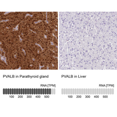 Anti PVALB pAb (ATL-HPA048536 w/enhanced validation)