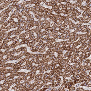 Anti GSTM1 pAb (ATL-HPA048652)