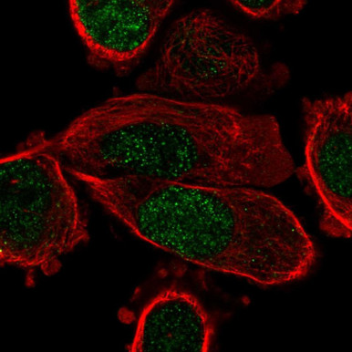 Anti PPARG pAb (ATL-HPA051239)