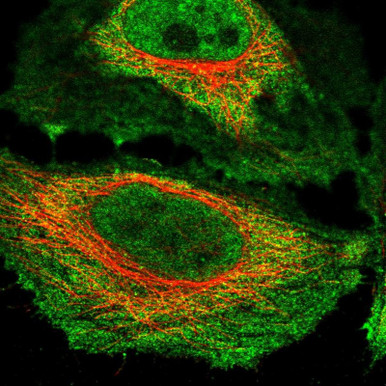 Anti NKTR pAb (ATL-HPA051576)