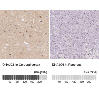 Anti DNAJC6 pAb (ATL-HPA054917 w/enhanced validation)
