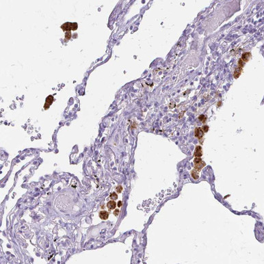 Anti ACP5 pAb (ATL-HPA059463)