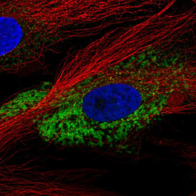 Anti COL1A2 pAb (ATL-HPA059738)