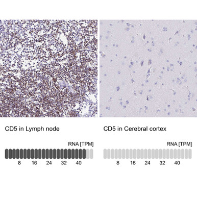 Anti CD5 pAb (ATL-HPA060839 w/enhanced validation)