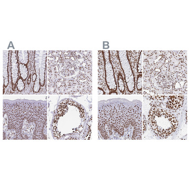 Anti EWSR1 pAb (ATL-HPA062953 w/enhanced validation)