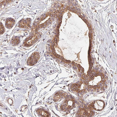 Anti MAPKAPK2 pAb (ATL-HPA063708)