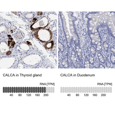Anti CALCA pAb (ATL-HPA064453 w/enhanced validation)
