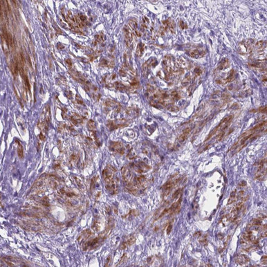 Anti PFKFB4 pAb (ATL-HPA066058)