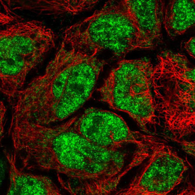 Anti CDK5RAP1 pAb (ATL-HPA066301)
