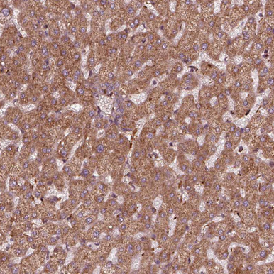 Anti FXN pAb (ATL-HPA068304)