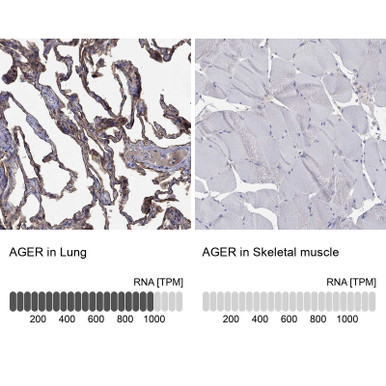 Anti AGER pAb (ATL-HPA069474 w/enhanced validation)