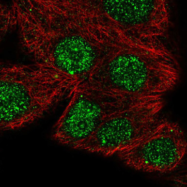 Anti NFATC1 pAb (ATL-HPA071732)