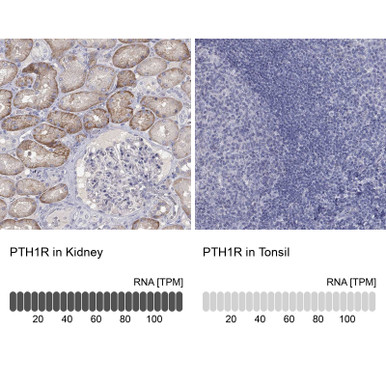 Anti PTH1R pAb (ATL-HPA075879 w/enhanced validation)