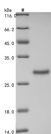 Recombinant Human Glutathione S-transferase Mu 3(GSTM3) (CSB-EP009982HU)