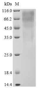 Recombinant Human Transcription factor SOX-9(SOX9) (CSB-YP022437HU)