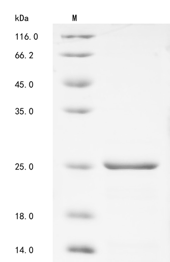 Recombinant Human Beta-synuclein(SNCB) (CSB-EP624090HUb1)