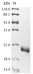 Recombinant Human TAR DNA-binding protein 43(TARDBP),partial (CSB-EP023129HU2)