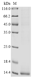 Recombinant Human Gamma-secretase subunit APH-1A(APH1A),partial (CSB-EP853390HU1)