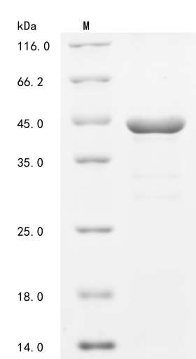 Recombinant Human Syntenin-1(SDCBP) (CSB-EP020893HUe3)