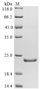 Recombinant Mouse Apoptosis regulator Bcl-2(Bcl2),partial (CSB-EP002611MOe1)