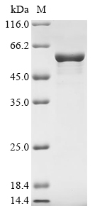 Recombinant Human Glial fibrillary acidic protein(GFAP) (CSB-EP009369HU)