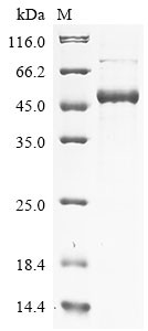 Recombinant Mouse Phenylalanine-4-hydroxylase(Pah) (CSB-YP017396MO)