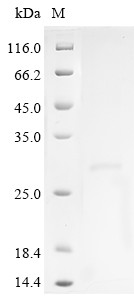 Recombinant Human Estrogen receptor(ESR1),partial (CSB-YP007830HU1)