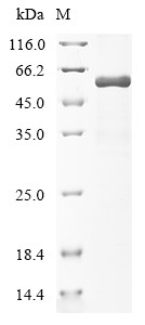 Recombinant Human Cellular tumor antigen p53(TP53) (CSB-BP024077HU)