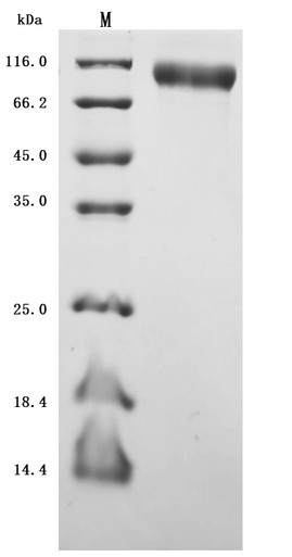 Recombinant Human Microtubule-associated protein tau(MAPT) (Active) (CSB-MP013481HU(F8))