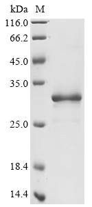Recombinant Human Transcription factor A, mitochondrial(TFAM) (CSB-EP023413HU)