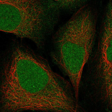 Anti-RIT2 pAb (ATL-HPA072526)