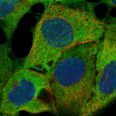 Anti-MAPK9 pAb (ATL-HPA072462)
