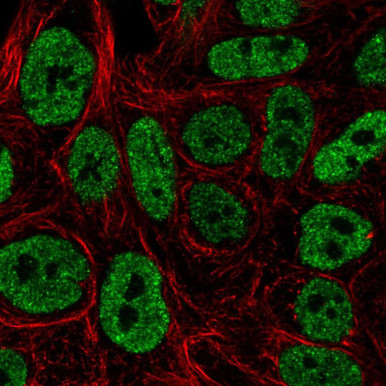 Anti-MAPK10 pAb (ATL-HPA068627)