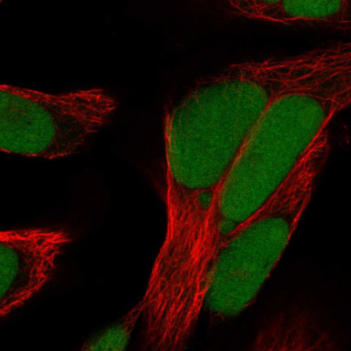 Anti-HMGB1 pAb (ATL-HPA073663)