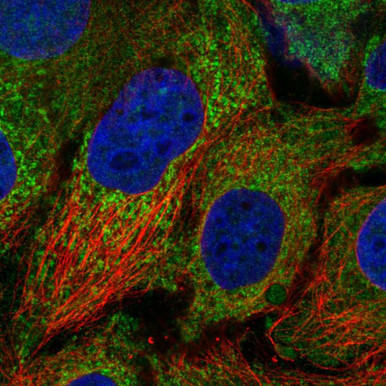 Anti-CDK5RAP1 pAb (ATL-HPA055429)