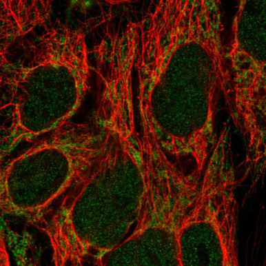 Anti-CDK5RAP1 pAb (ATL-HPA051329)