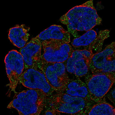 Anti-CD27 pAb (ATL-HPA069501)