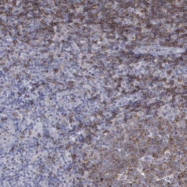 Anti-CD22 pAb (ATL-HPA066523)
