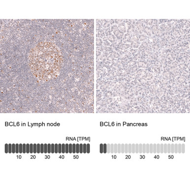 Anti-BCL6 mAb (Clone CL14612, ATL-AMAb91978 w/enhanced validation)