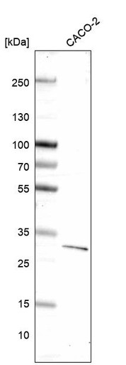 Anti-DKK1 mAb (Clone CL14707, ATL-AMAb91989)