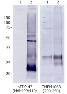 Anti TMEM106B (239-250) pAb