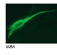 Anti-GFAP (Glial Fibrillary Acidic Protein) mAb (Clone: MO389)