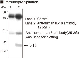 Anti-IL-18 (Clone 125-2H) (Human) mAb (Clone: 125-2H)