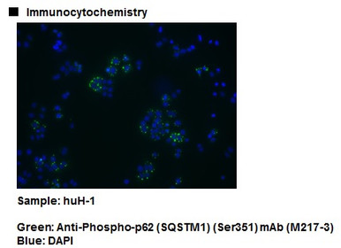 Anti-Phospho-p62 (SQSTM1) (Ser351) mAb (Clone: 5D5)